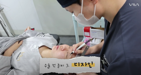 화려와 자연스러움의 중간 자려라인의 정석 직반라인 코 성형 관련 이미지 8