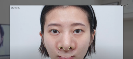 코재수술 원인, 과연 코끝처짐만이 문제일까? 가장 이상적인 라인 알려드립니다 관련 이미지 14