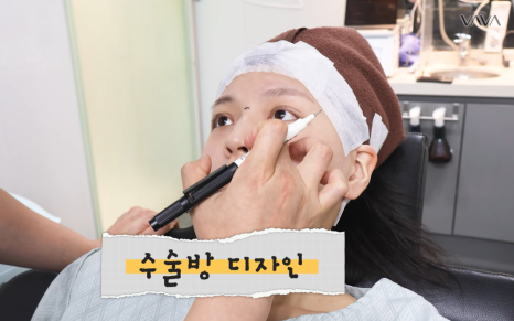 보형물 없이 선명하게｜바바성형외과 무보형물 매부리코 교정 리얼 후기 관련 이미지 5