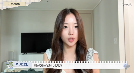 코재수술로 인상까지 달라질 수 있을까?｜바바성형외과 직반라인 코재수술 후기 관련 이미지 18