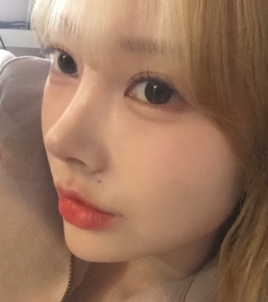 코 성형 단순한 외모 변화뿐일까? 관련 이미지 13