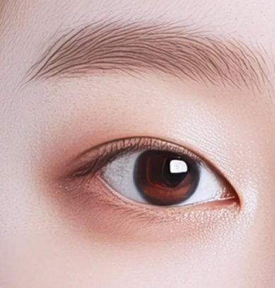 쌍수만으로 충분할까? 윗트임 병행이 필요한 경우 관련 이미지 6