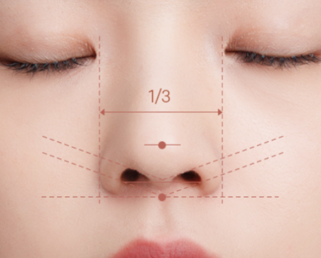 코 재수술, 첫 수술보다 더 신중해야 하는 이유 관련 이미지 4