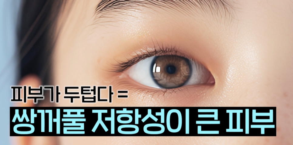 쌍꺼풀 수술 짧은 회복기 가능? 종류별 차이 완전 정리 관련 이미지 12