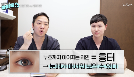 세미아웃라인 인아웃라인 쌍꺼풀 잘 받는 타입 (몽고주름) 관련 이미지 12