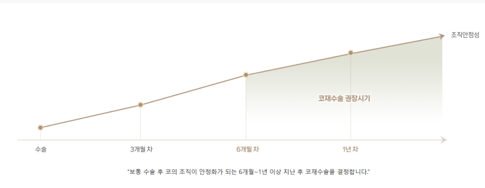 최준희 코 재수술 눈 재수술 성형 분석 관련 이미지 14