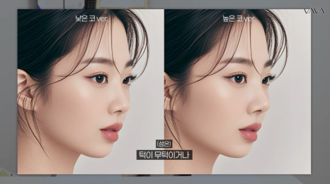 첫 코 성형, 언제&middot;어떻게 해야 할지 기준 정리해드립니다 관련 이미지 29