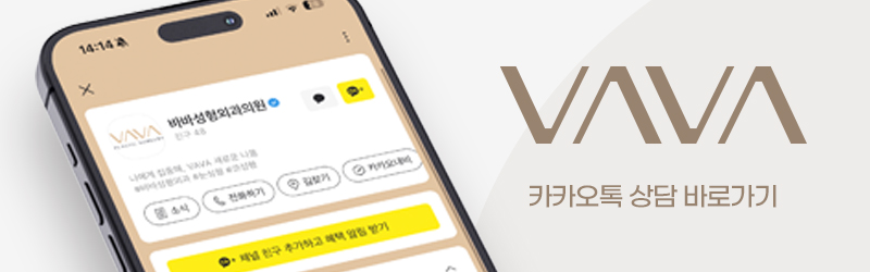 압구정 바바성형외과 자가늑 코성형 후기｜복코&middot;매부리코 교정 한달차 변화 관련 이미지 26