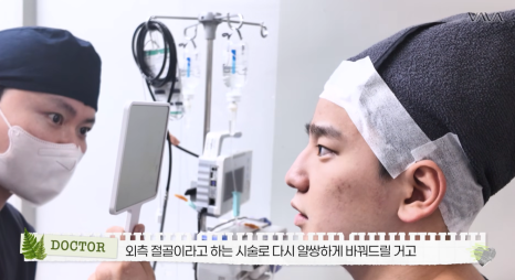 무보형물 직선라인 코성형으로 주먹코&middot;복코 개선｜압구정 바바성형외과 사례 관련 이미지 10