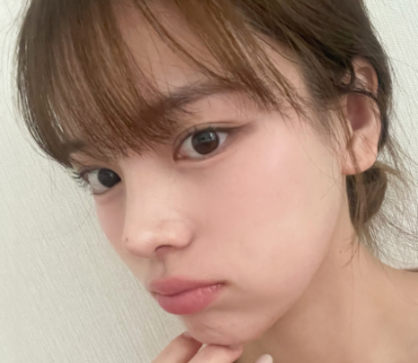 코 재수술, 첫 수술보다 더 신중해야 하는 이유 관련 이미지 17