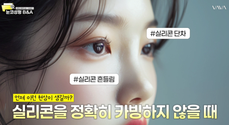 복코 매부리코 긴코 교정 ㅣ 코성형 전후 케이스 (NJZ민지 코) 관련 이미지 22