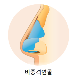 입체적이고 균형 잡힌 코 라인을 위한 자가연골 코 성형(비중격, 귀연골, 늑연골) 관련 이미지 6