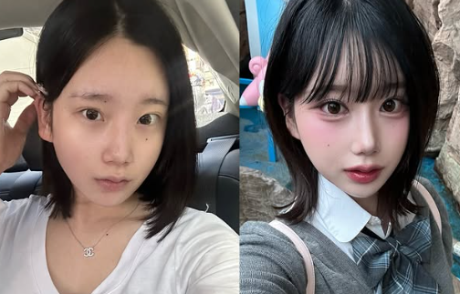 2025년 코성형 트렌드: 자연스러움이 대세 관련 이미지 4