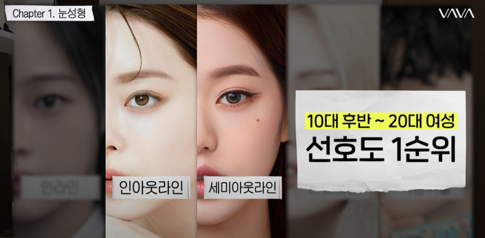 겨울방학 쌍꺼풀 수술, 이것만은 꼭 알아두세요｜쌍꺼풀 수술 가이드 관련 이미지 6