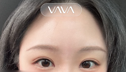 과하지 않게 또렷한 눈매, 세미아웃라인&middot;인아웃라인 쌍꺼풀 인기 이유 관련 이미지 4