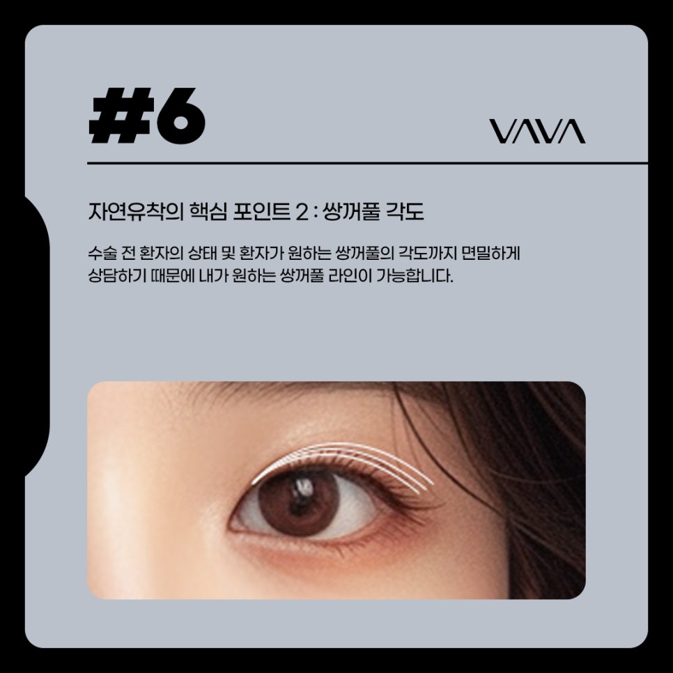 자연유착 쌍꺼풀 내게 어울리는 비율로 관련 이미지 6