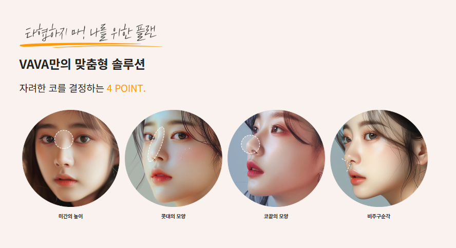 화려와 자연스러움의 중간 자려라인의 정석 직반라인 코 성형 관련 이미지 3