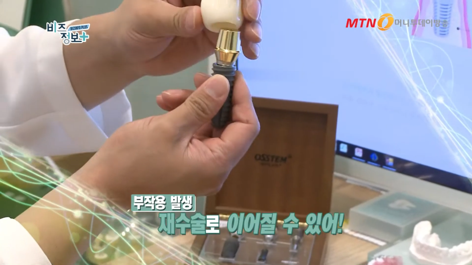 임플란트 주의사항 잇몸뼈의 상태도 봐야 관련 이미지 5