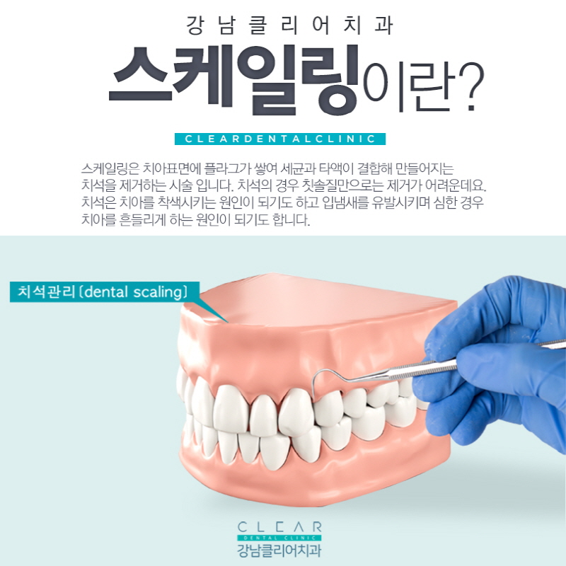 구강관리의 시작 치아스케일링 보험적용까지 관련 이미지 2