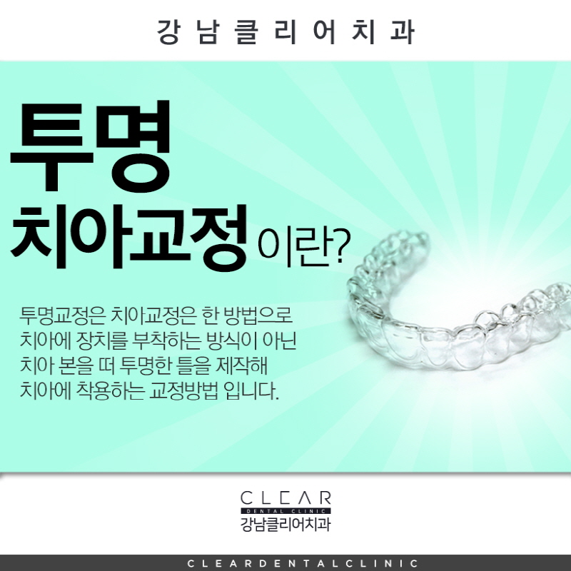 강남역투명교정 무엇을 중점으로 봐야할까요? 관련 이미지 2