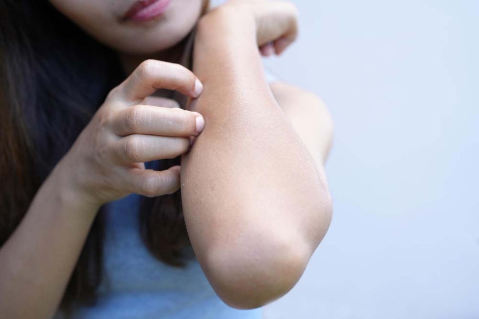 당뇨 초기증상 피부 가려움증 원인 해결방법 관련 이미지 3