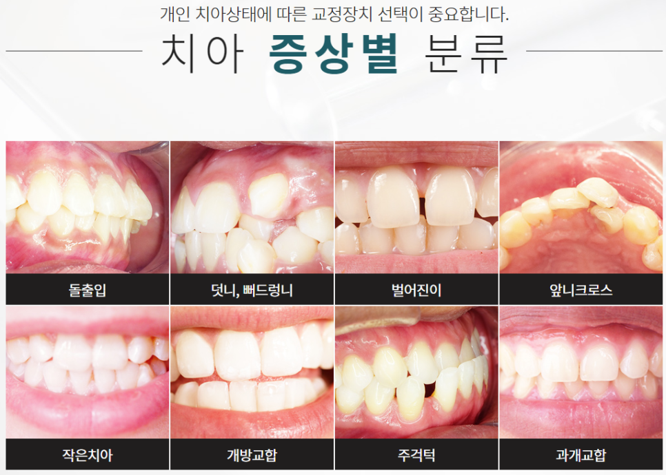 반포동교정치과 보다 긍정적인 이미지로! 관련 이미지 5
