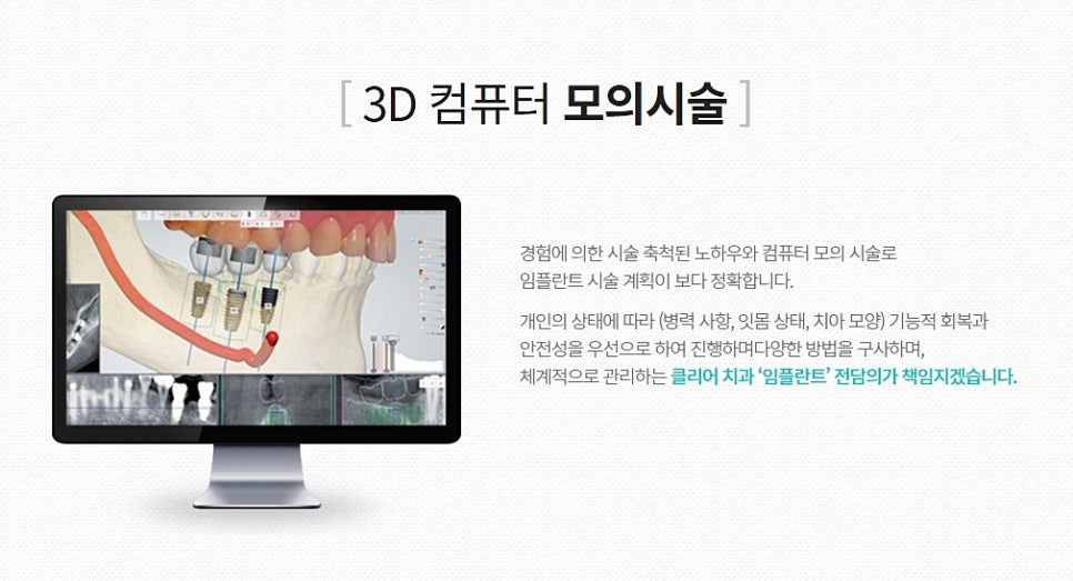 강남클리어치과 임플란트 찾고 결정 관련 이미지 5