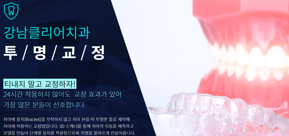 논현동치아교정 틀어진 정도 파악이 우선 관련 이미지 6