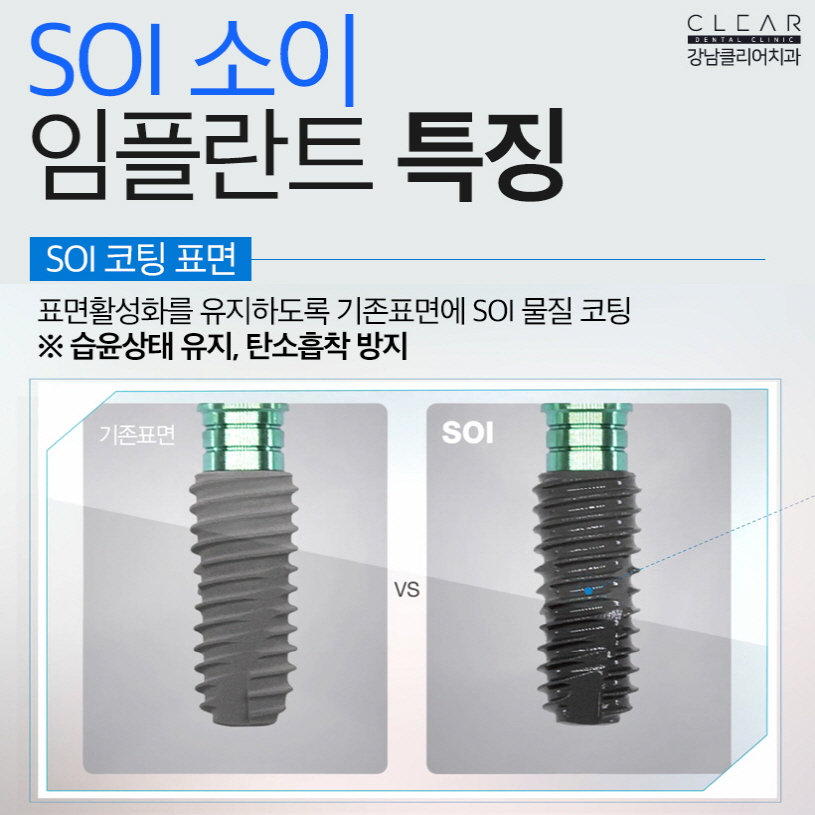 오스템임플란트 SOI임플란트 무엇이 다를까요? 관련 이미지 7