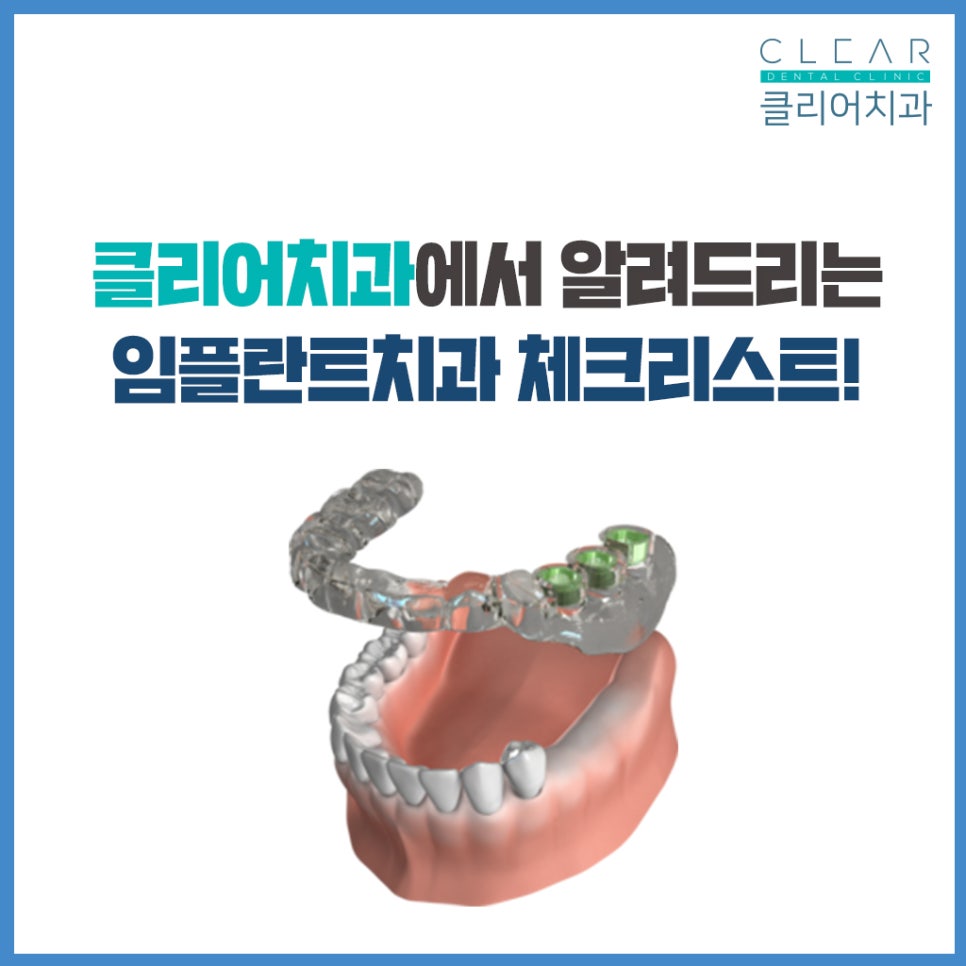 강남클리어치과 유용한팁 - 임플란트치과 체크리스트 관련 이미지 2