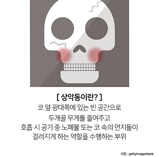 잇몸뼈가 부족해 임플란트 수술 어렵다면? 관련 이미지 7
