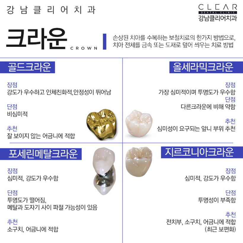 강남역충치치료 나에 충치 단계에 맞게 관련 이미지 8