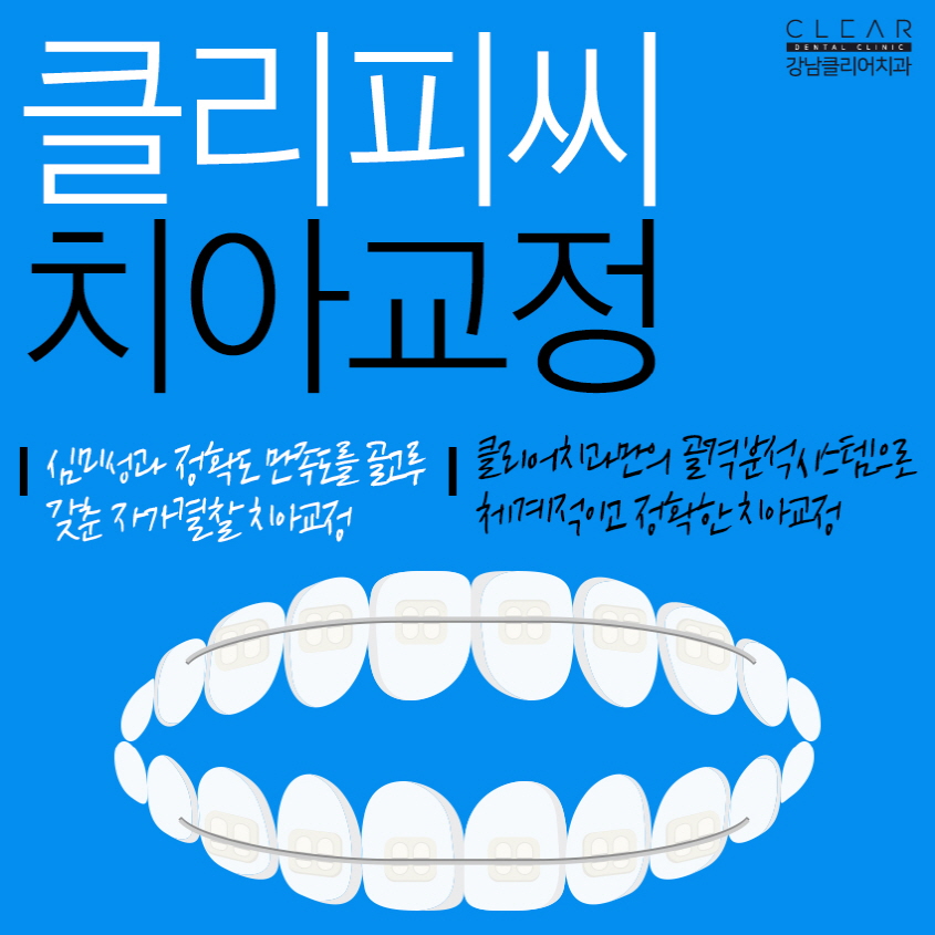클리피씨교정치과 눈에 덜띄고 교정효과는 확실하게 관련 이미지 1