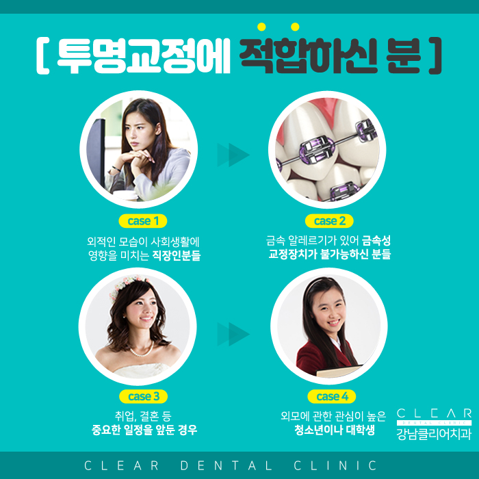 강남투명교정 티 내지 말고 교정하자! 관련 이미지 3