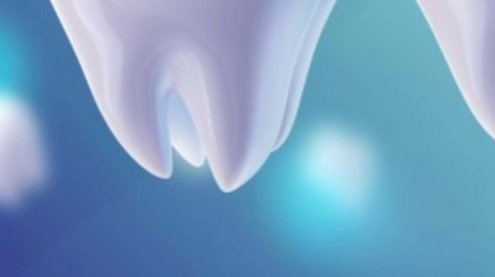 강남클리어치과 상악동 거상술도 가능하니까 관련 이미지 22