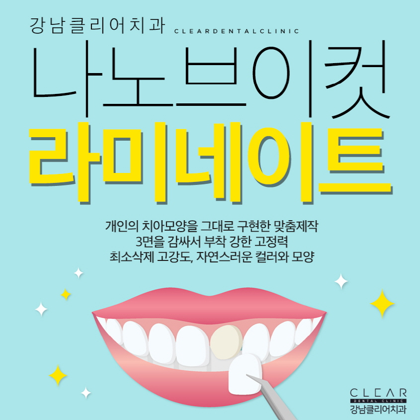강남역 라미네이트 잘하는 치과 간단하고 효과적인 치료 관련 이미지 1