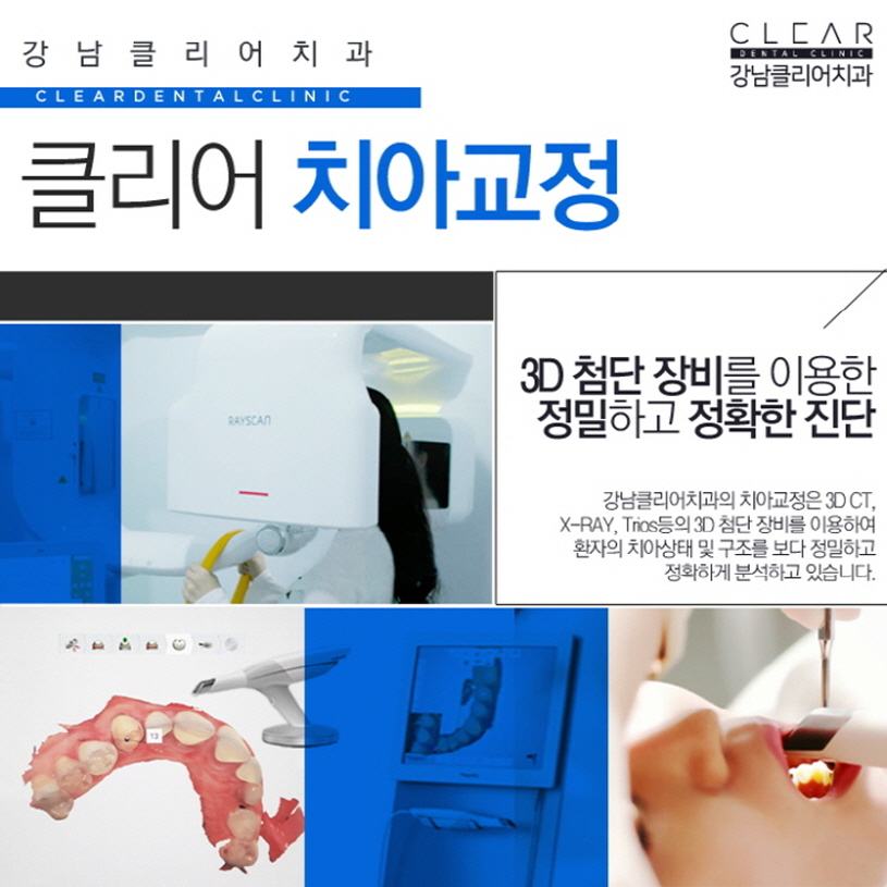 강남역 투명교정 교정티 안나는 치아교정 관련 이미지 6