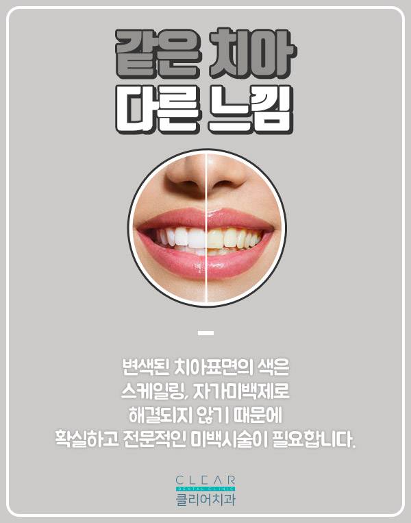 반짝반짝 눈이 부시는 클리어 치아미백 관련 이미지 5