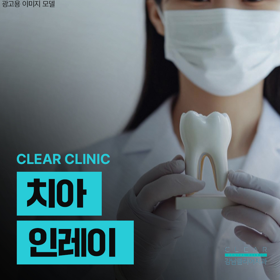치아 인레이 이럴때 필요해요 관련 이미지 1