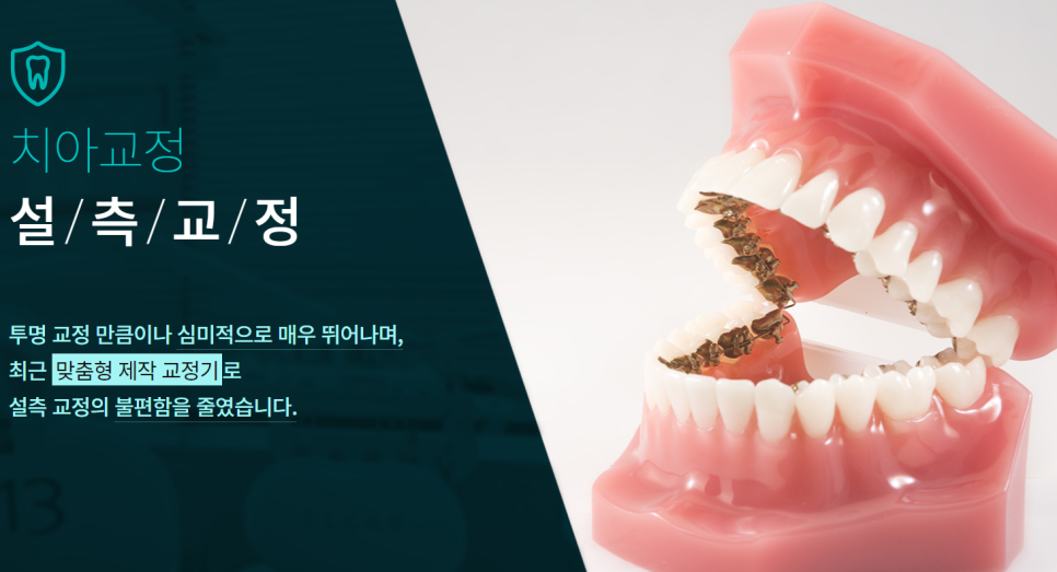 강남치과 교정치료 반듯한 치아 배열 강남교정치과 관련 이미지 7