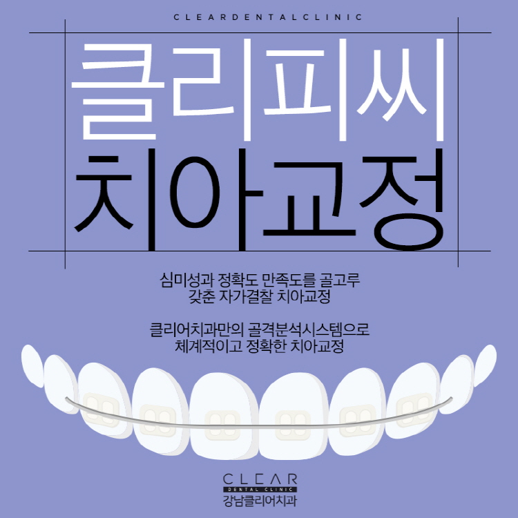 클리피씨교정치과에서 알려주는 장점들 관련 이미지 1