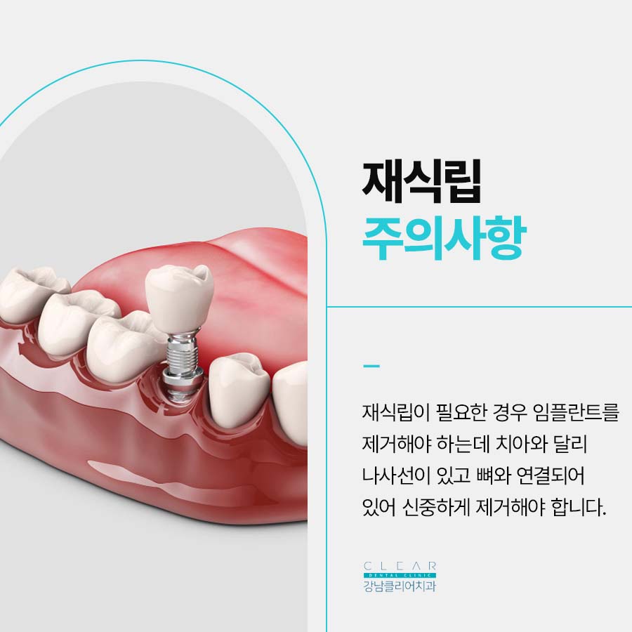임플란트 재식립 필요한 경우 주의사항은 관련 이미지 3
