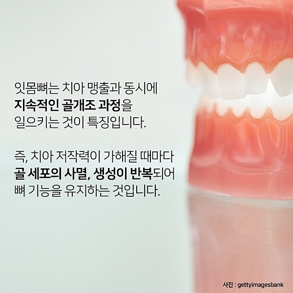 잇몸뼈가 부족해 임플란트 수술 어렵다면? 관련 이미지 5