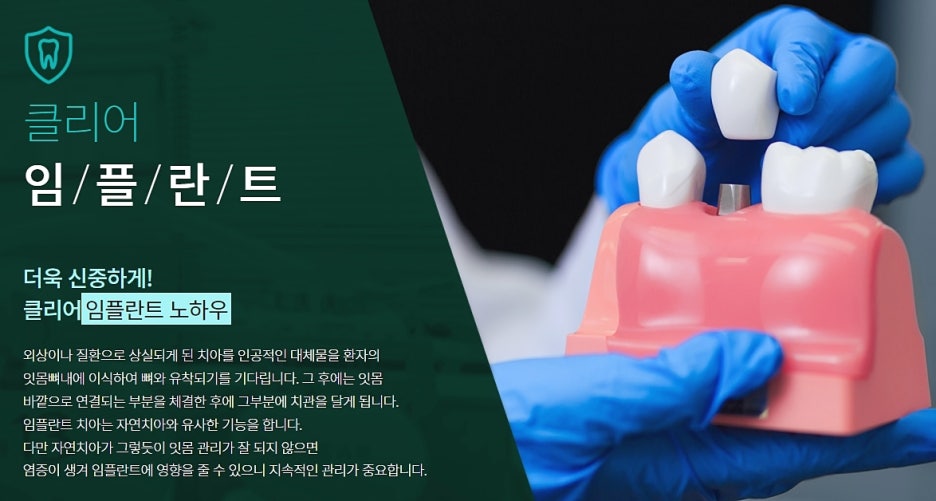 임플란트 실비 가능한지 찾는다면? 관련 이미지 2