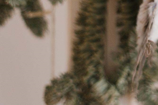 라미네이트 치아삭제 꼭 필요한 만큼만 해요 관련 이미지 30