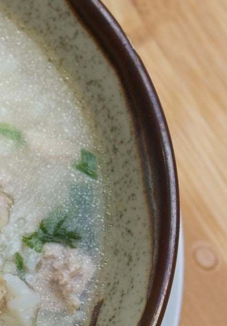 위내시경 금식시간 전날 음식 피해야 할 것은 관련 이미지 11