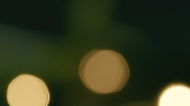 임플란트 빠졌을때 빠지는 이유 대처법 알려드려요 관련 이미지 24