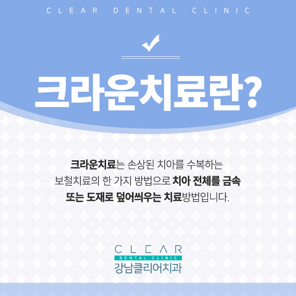 강남역치과 추천 치아 보철치료 관련 이미지 4