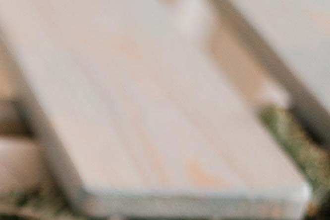 라미네이트 치아삭제 꼭 필요한 만큼만 해요 관련 이미지 26