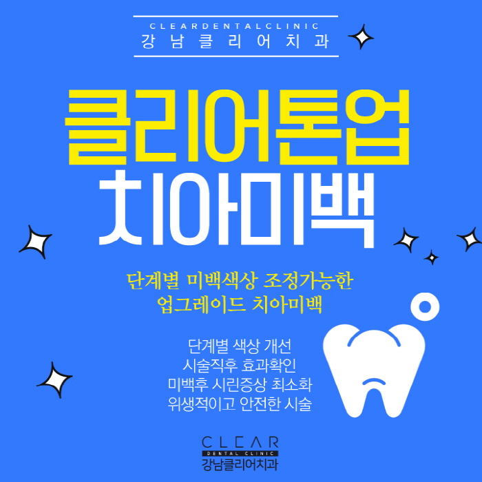강남치아미백 이벤트 가격 효과 모두 만족 관련 이미지 1